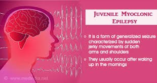 Juvenile Myoclonic Epilepsy Life Expectancy